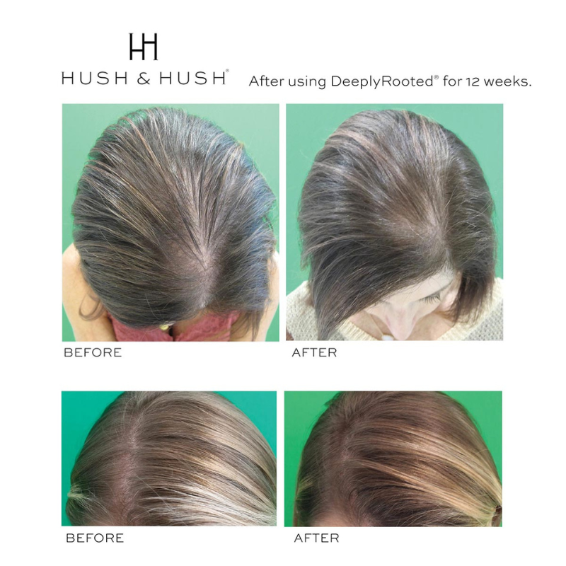 Vorher-Nachher-Bilder von Haaren nach 12 Wochen Anwendung von Hush & Hush DeeplyRooted.