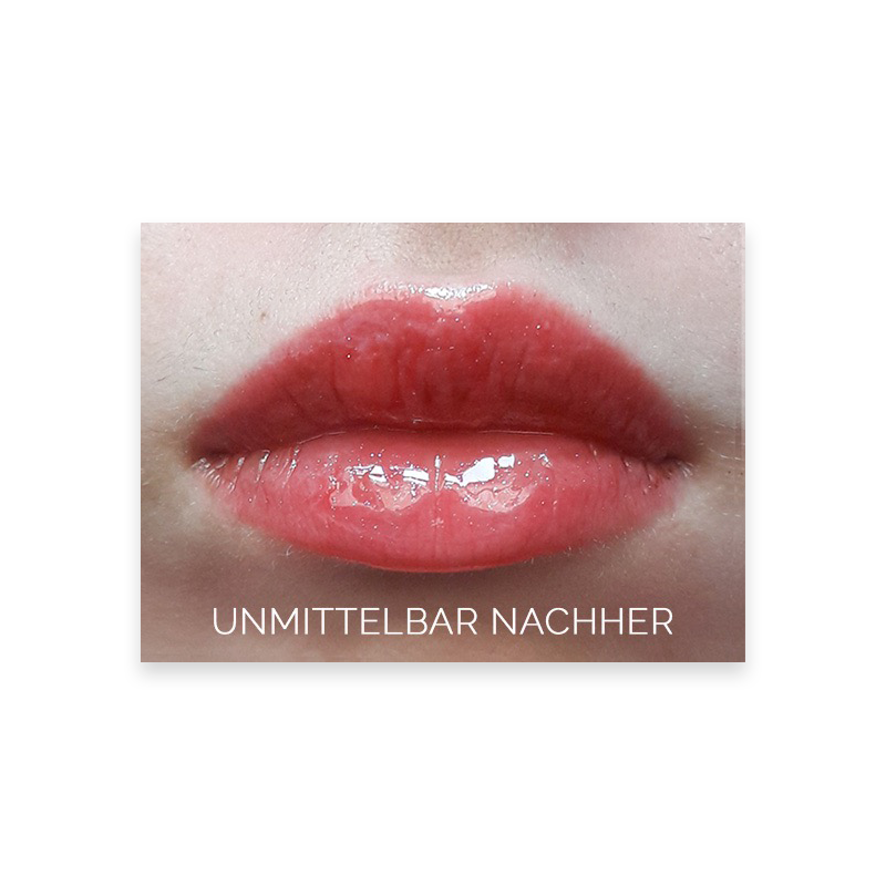 lusciouslips-lippen-nachher5a659423f0fa2